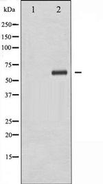 Phospho-XIAP / BIRC4 (Ser87) Antibody in Western Blot (WB)