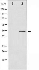 Phospho-SMAD3 (Thr179) Antibody in Western Blot (WB)