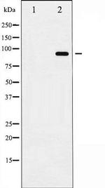 Phospho-CD156b/ADAM17 (Thr735) Antibody in Western Blot (WB)