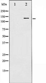 Phospho-p130 Cas / BCAR1 (Tyr410) Antibody in Western Blot (WB)