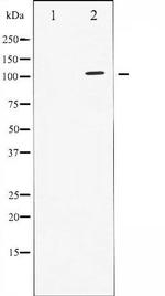 Phospho-STAT2 (Tyr690) Antibody in Western Blot (WB)