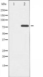 Phospho-Etk / BMX (Tyr566) Antibody in Western Blot (WB)