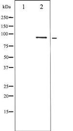 Phospho-STAT5 beta (Ser731) Antibody in Western Blot (WB)