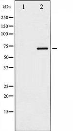 Phospho-Paxillin (Tyr118) Antibody in Western Blot (WB)