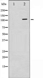 Phospho-c-PLA2 (Ser505) Antibody in Western Blot (WB)