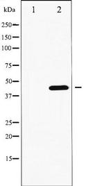 Phospho-GATA4 (Ser262) Antibody in Western Blot (WB)
