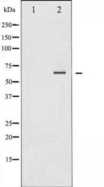 Phospho-SYK (Tyr348) Antibody in Western Blot (WB)