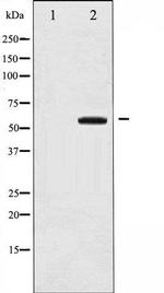 Phospho-COT/TPL-2 (Thr290) Antibody in Western Blot (WB)
