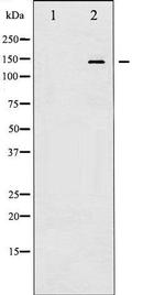 Phospho-Calcium Sensing Receptor (Thr888) Antibody in Western Blot (WB)