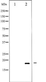 Phospho-alpha Synuclein (Tyr136) Antibody in Western Blot (WB)