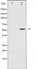 Phospho-PPAR-gamma (Ser112) Antibody in Western Blot (WB)