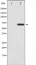 Phospho-NF2 / Merlin (Ser518) Antibody in Western Blot (WB)
