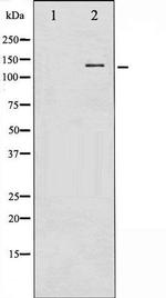 Phospho-nNOS (Ser852) Antibody in Western Blot (WB)