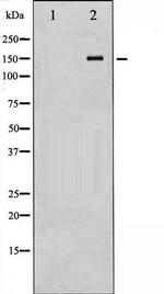 Phospho-eNOS (Thr494) Antibody in Western Blot (WB)