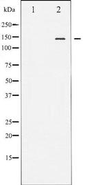 Phospho-eNOS (Ser1176) Antibody in Western Blot (WB)