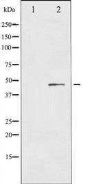 Phospho-IL-8R beta / CXCR2 (Ser347) Antibody in Western Blot (WB)
