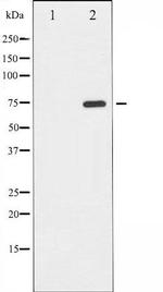 Phospho-PKR/PRKR (Thr446) Antibody in Western Blot (WB)