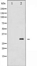 Phospho-Cardiac Troponin I (Thr142) Antibody in Western Blot (WB)