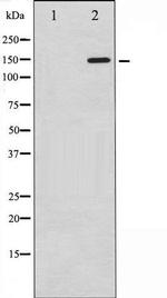 Phospho-PLCG1 (Tyr771) Antibody in Western Blot (WB)