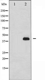 Phospho-NCF1 / p47 phox (Ser359) Antibody in Western Blot (WB)