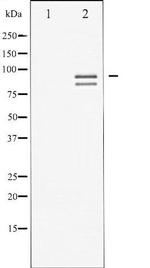 Phospho-Glycogen Synthase (Ser645) Antibody in Western Blot (WB)