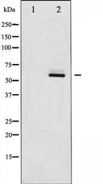 Phospho-SRC (Ser75) Antibody in Western Blot (WB)