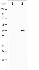 Phospho-SRF (Ser99) Antibody in Western Blot (WB)
