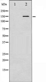 Phospho-Bcr (Tyr360) Antibody in Western Blot (WB)