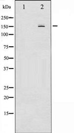 Phospho-PDGF Receptor beta (Tyr740) Antibody in Western Blot (WB)