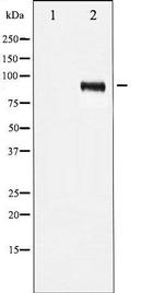 Phospho-IGF1R (Tyr1161) Antibody in Western Blot (WB)