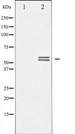 Phospho-Lyn (Tyr507) Antibody in Western Blot (WB)
