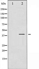 Phospho-beta-2 Adrenergic Receptor (Ser346) Antibody in Western Blot (WB)