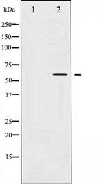 Phospho-Tyrosine Hydroxylase (Ser31) Antibody in Western Blot (WB)