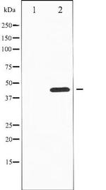 Phospho-Tyrosine Hydroxylase (Ser19) Antibody in Western Blot (WB)
