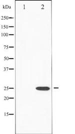 Phospho-EIF4E (Ser209) Antibody in Western Blot (WB)