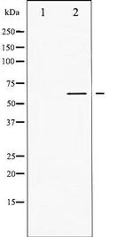 Phospho-Lck (Tyr505) Antibody in Western Blot (WB)