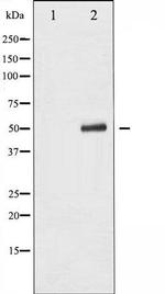 Phospho-p53 (Ser315) Antibody in Western Blot (WB)