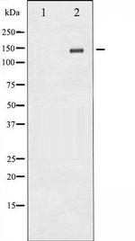Phospho-ErbB2 (HER-2) (Tyr1112) Antibody in Western Blot (WB)