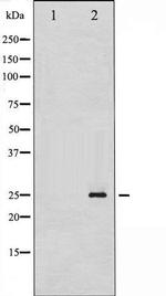 Phospho-Thymidine Kinase 1 (Ser13) Antibody in Western Blot (WB)