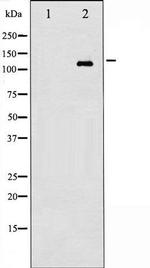 Phospho-EGFR (Ser695) Antibody in Western Blot (WB)