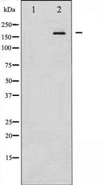 Phospho-EGFR (Tyr1092) Antibody in Western Blot (WB)