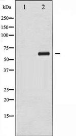 Phospho-Chk2 (Thr383) Antibody in Western Blot (WB)