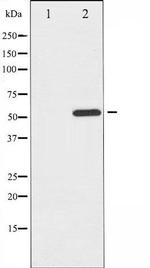 Phospho-MiTF (Ser73, Ser180) Antibody in Western Blot (WB)