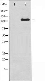 Phospho-JAK2 (Tyr570) Antibody in Western Blot (WB)