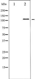 Phospho-JAK2 (Tyr931) Antibody in Western Blot (WB)