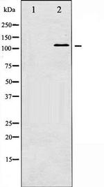 Phospho-JAK2 (Tyr221) Antibody in Western Blot (WB)