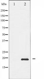 Phospho-Survivin (Thr117) Antibody in Western Blot (WB)