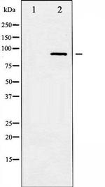 Phospho-IKK-beta (Tyr199) Antibody in Western Blot (WB)