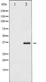 Phospho-I-kappa-B-epsilon (Ser22) Antibody in Western Blot (WB)