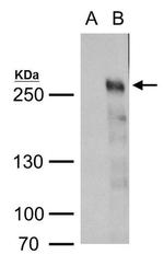 TET2 Antibody in Western Blot (WB)